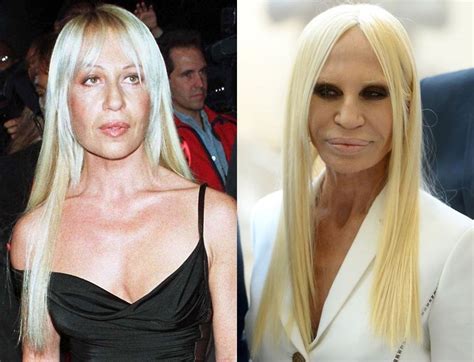 dove lavora donatella versace|donatella versace before and after.